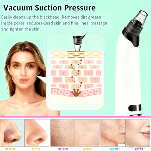 Blackhead Remover Pore Vacuum with Hot Compress, 69KPa Suction