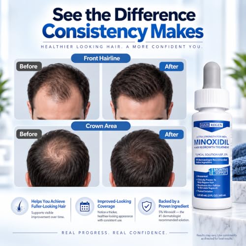 Men's Minoxidil Hair Regrowth Liquid 5% Topical Solution for Thicker Hair
