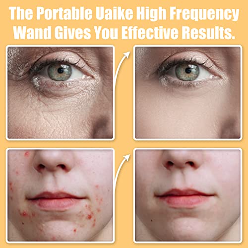Uaike High Frequency Facial Wand 6 in 1 with Purple Glass Tubes