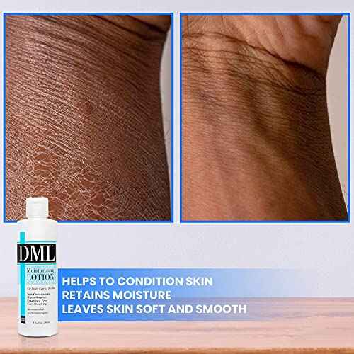 Dml Dml Moisturizing Lotion, 8 oz (Pack of 2)