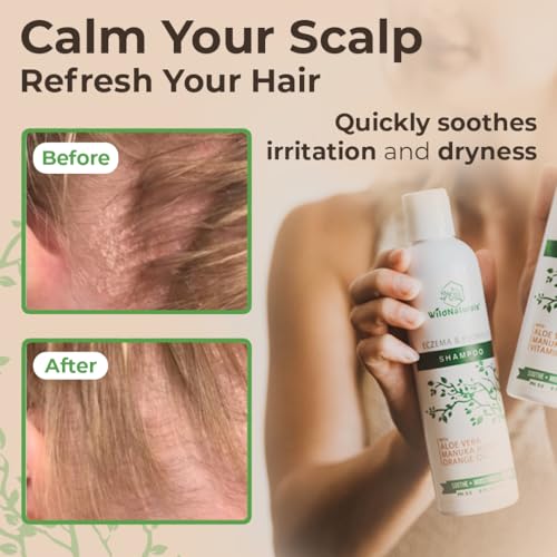 Wild Naturals Eczema & Psoriasis Shampoo for Sensitive Scalp