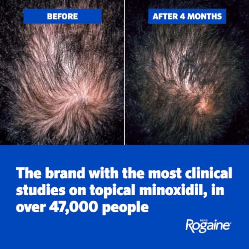 Men's Rogaine 5% Minoxidil Hair Regrowth Foam - Unscented, 3x2.11 oz