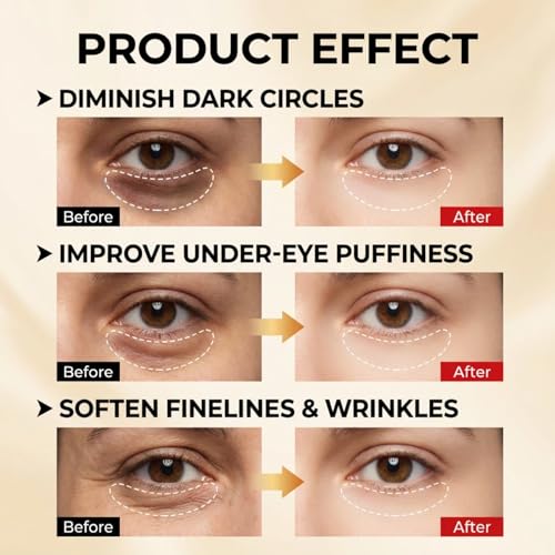 Bighero Perfection Eye Tightener with Brush – Instant Lift