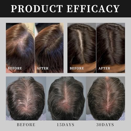 Hair Growth Serum Bundle - Dual-Step Scalp Care System