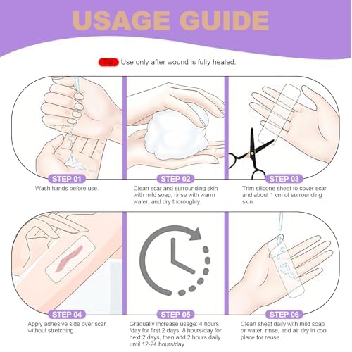 WZPB Silicone Scar Sheets for Scar Removal - Medical Grade Scar Tape for Surgical Scars, C-Section, Keloid, Hypertrophic & Acne Scars | 1.5" x 120" Reusable & Waterproof Scar Strips Roll (2 Pack)