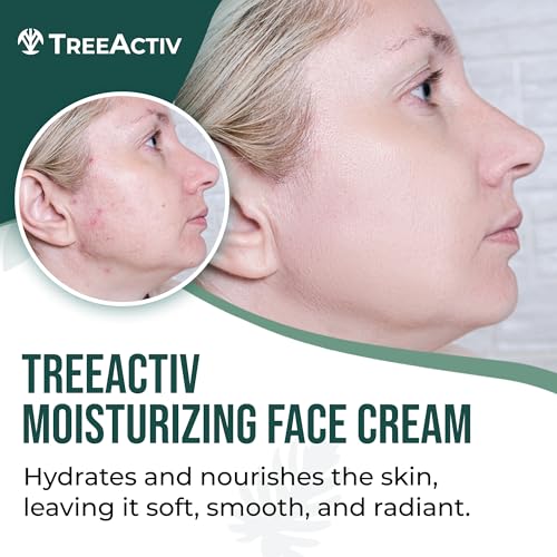 TreeActiv Acne Cream Original Formula, 2 fl oz, 2% Salicylic Acid Face Moisturizer for Oily & Acne-Prone Skin, Lightweight Hydrating Facial Cream
