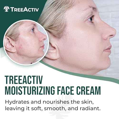 TreeActiv Acne Cream Original Formula, 2 fl oz, 2% Salicylic Acid Face Moisturizer for Oily Skin, Skin Care Acne Formula for Cystic Acne Treatment, Hydrating Face Moisturizer for Acne Prone Skin