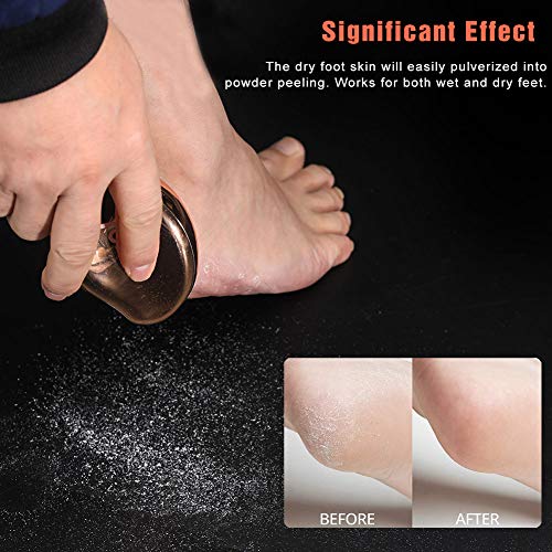 BEZOX Nano Glass Foot File Callus Remover - Portable Pedicure Scrubber (Gold)