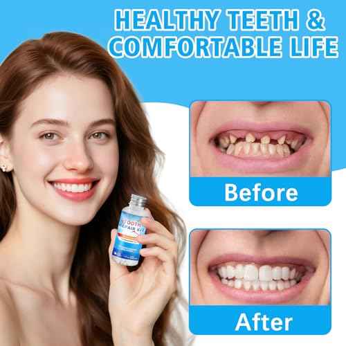 Tooth Repair Kit, Moldable False Teeth Beads, for Missing, Broken Temporary Thermoplastic Beads, Comfortable DIY at Home Use