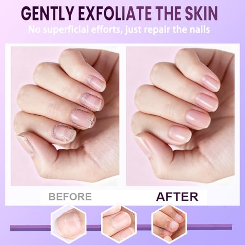 3-in-1 Cuticle Oil Pen with Ceramic Tip - Nail Care Tool (2 Pcs)