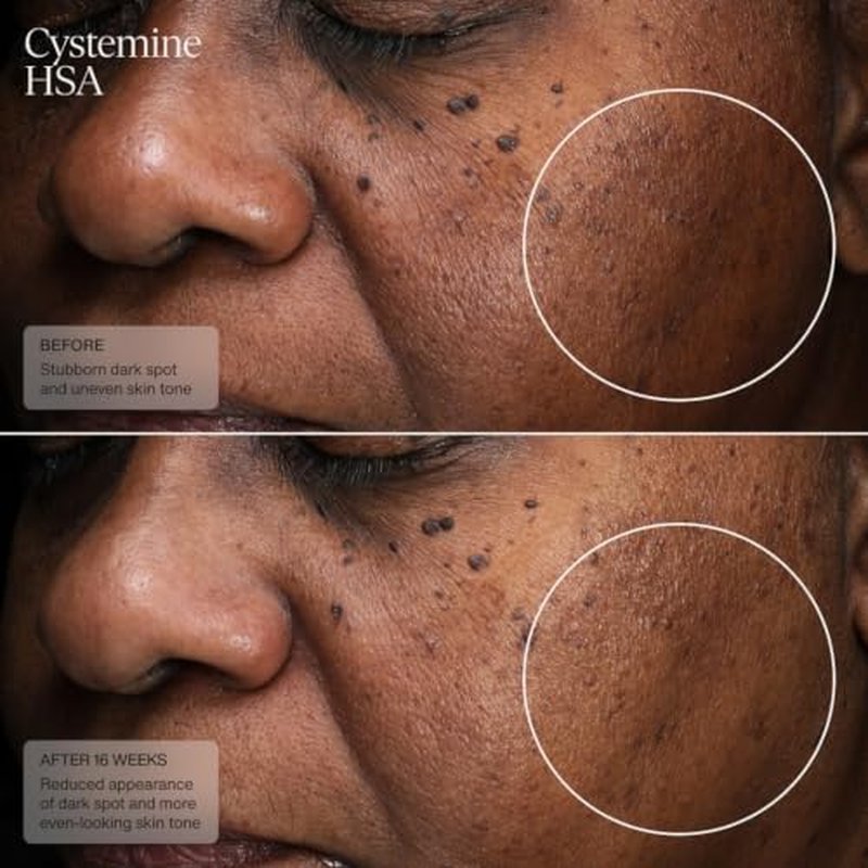 Senté Cysteamine HSA Dark Spot Corrector Cream - 1.7 Fl Oz