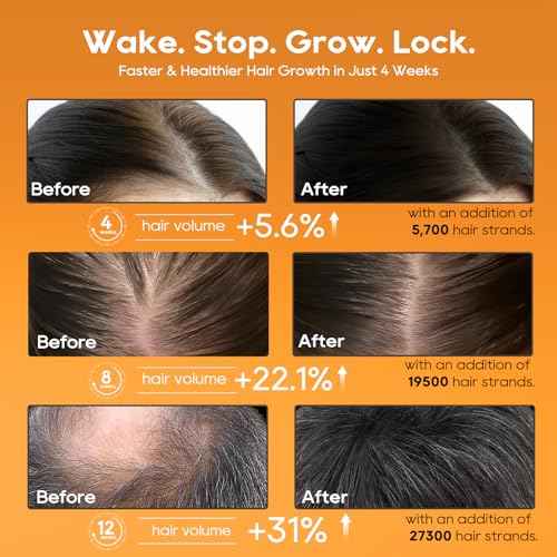 Women¡®s Hair Growth Serum Oil, 100% Natural Herbal Extracts, Root Revive Visibly Thickening Fuller Hair, Follicle Stimulator Scalp Serum for Hair Loss/Shedding,Thin, Dry & Damaged Treatment