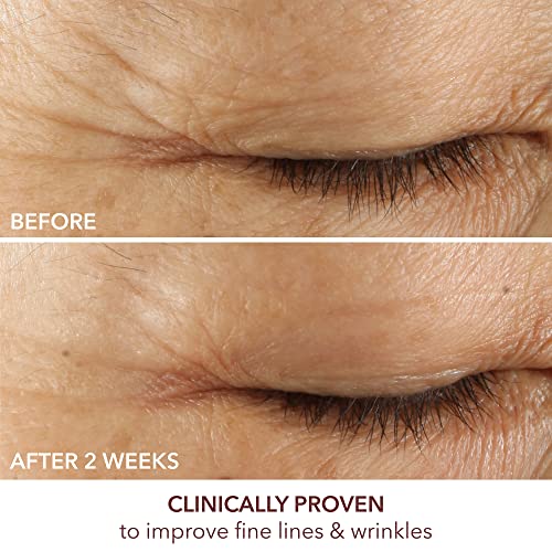 Advanced Retinol & Ferulic Eye Serum – Triple Correction 15ml