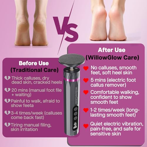 Professional Electric Foot Callus Remover, 9-Speed Cordless Foot File with Reusable Nano Glass Heads & Sandpaper for Dead Skin Removal and Smooth Feet