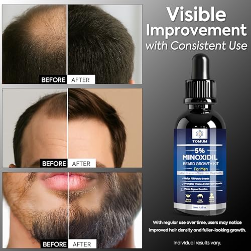 TOMUM 5% Minoxidil Beard Growth Serum for Men