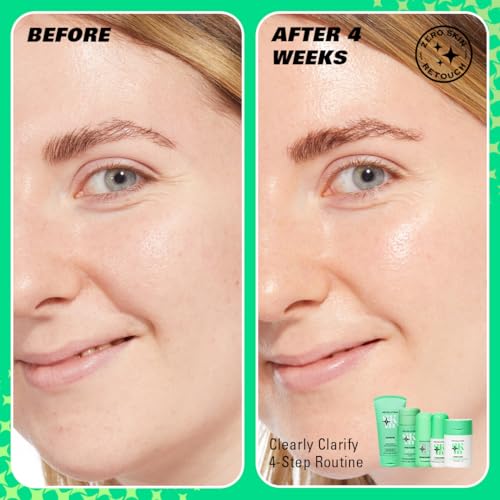 Revolution Skin, Clearly Clarify 4 Step Starter Kit, Skincare Set for Blemish-Prone Skin with Cleanser, Toner, Serum & Moisturizer, Vegan & Cruelty-Free, 4 Mini Products
