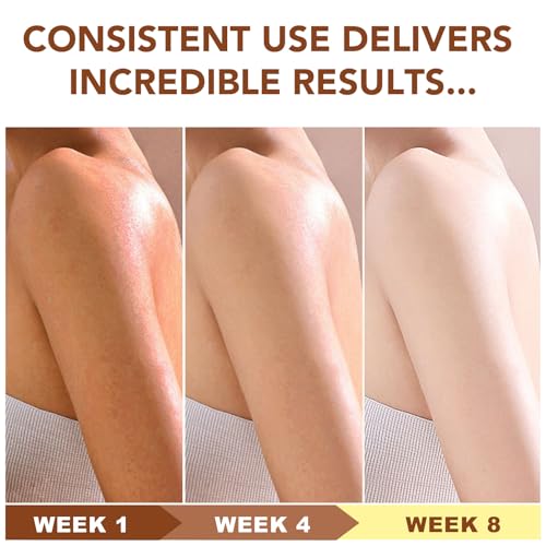 Unrefined Shea Butter Raw Organic for Skin and Hair, Pure and Natural Raw Shea Butter Moisturizer for Dry Skin Care 1Pack