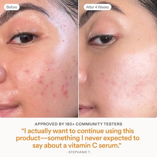 Skinfix Brighten + Firm 15% Vitamin C Serum for Face - Visibly Fades Dark Spots & Fine Lines - Safe for Sensitive & Aging Skin