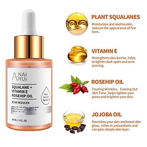 ANAI RUI Squalane Oil Set-Vitamin E Rosehip Oil +Vitamin C Turmeric Oil +Retinol Jojoba Oil for face,Moisturize Fine Lines &Wrinkle,Softer Skin