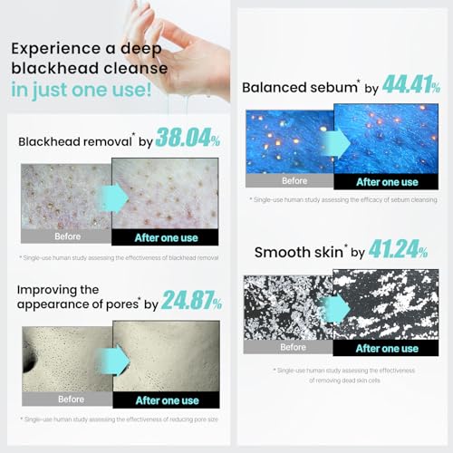 ilso Super Melting Sebum Cleansing Oil - Makeup & Blackhead Remover