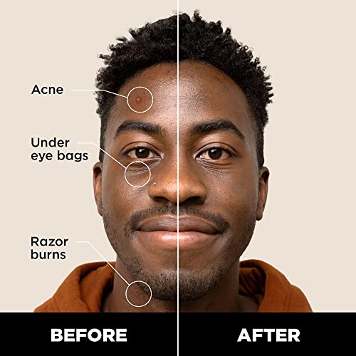 Stryx Concealer Stick Tool for Men, Dark Eclipse - Natural Pigments Hides Imperfections, Acne, Razor Burns, Scars, & Rosacea - Highly Adaptable Shades for Easy, Undetectable Coverage - All Skin Tones