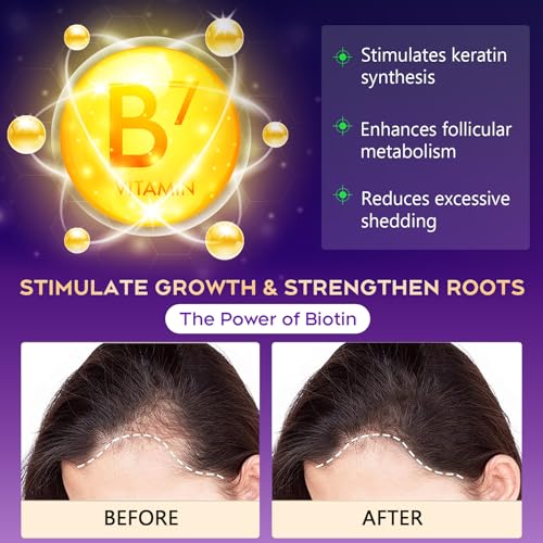 Biotin Hair Growth Shampoo for Thinning Hair, 10.1 fl oz