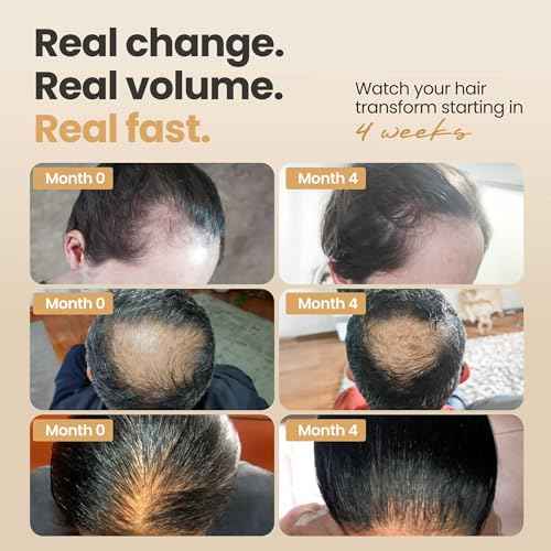 Vitasei Hair Booster 2 Fl Oz ? Hair Revitalizing Serum with Capilia Longa, Wild Olive Stem Cells & Arginine ? Peptide-Enriched Hair Tonic for Thicker, Stronger Hair ? Natural Hair Care for Women & Men