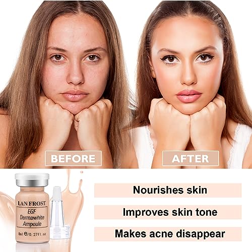 BB Facial Glow Serum Starter Kit Hyaluronic Acid Essence Foundation Skin Care Kit 0.27oz 12 Vials, Combined With Niacinamide and Peptides To Brighten Skin Tone Anti-Aging Foundation Light Rose #3