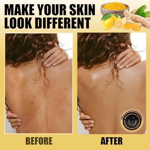 Foaming Body Scrub Turmeric & Lemon | Natural Exfoliating Body Scrub for All Skin Types| Brightening Body Scrub, Hydrating Turmeric Scrub for Dark Spots, Smooth Skin (280g)