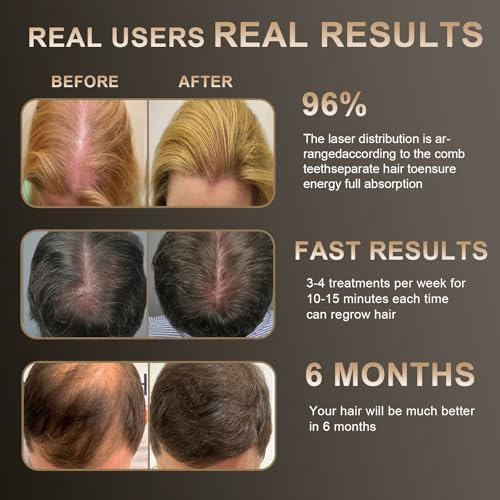 Laser Hair Growth Comb by Apbier | Handheld Device