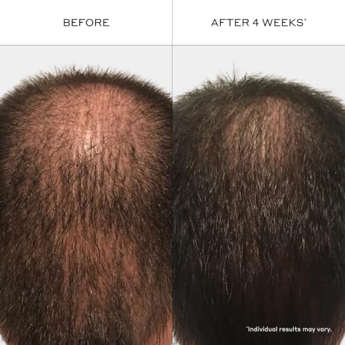 Zenagen Revolve Men's Thickening Shampoo for Thinning Hair
