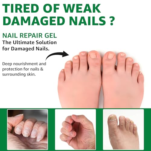 40% Urea Nail Repair Gel with Brush - Moisturizes Brittle Nails 30ml