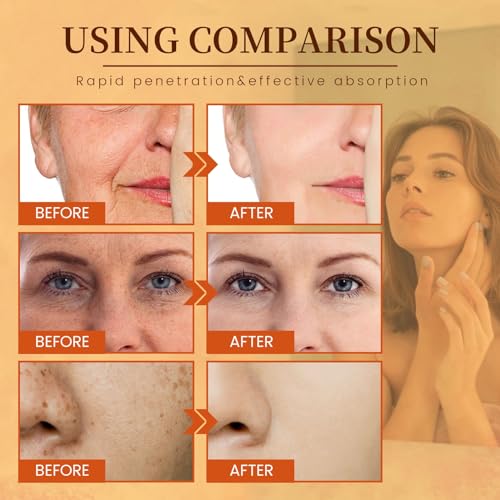 Vitamin C Face Serum, Vitamin C Serum For Face, 100% Pure Vitamin C Serum For Facial Moisturizing, Firming Skin, And Even Skin Tone - 30 ml