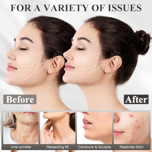 V-Line Lifting Mask | Chin Strap for Jawline Shaping