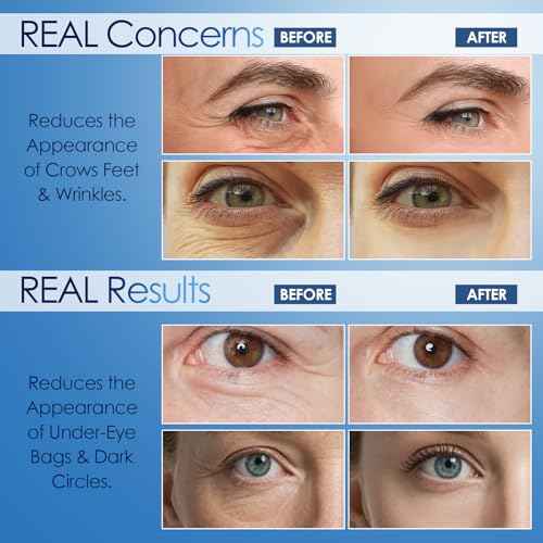 Instant Visible Reduction Serum- Reduces Under-Eye Bags & Wrinkles, Powered by Pepitide and Collagen, Anti-Aging Cream for Fine Lines (0.17 Fl.OZ)