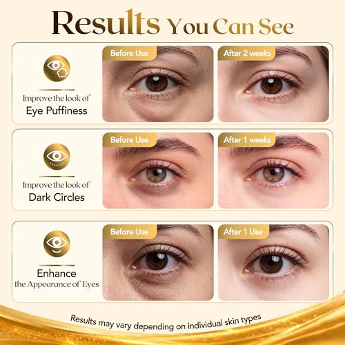 80 PCS Gold Collagen Under Eye Patches with Hyaluronate