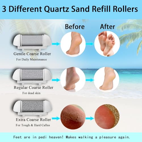Electric Foot Callus Remover Kit with 3 Rollers & 2 Speeds
