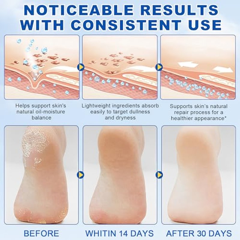 60% Urea Foot Cream Stick with 2% Salicylic Acid - Callus Remover