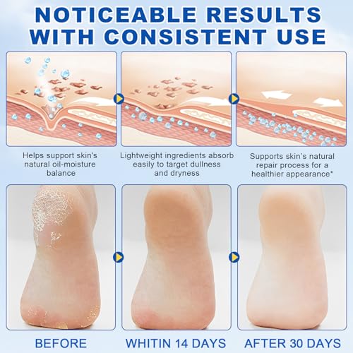 ConfidMiss 60% Urea Foot Care Stick for Cracked Heels & Calluses (2 Pack)