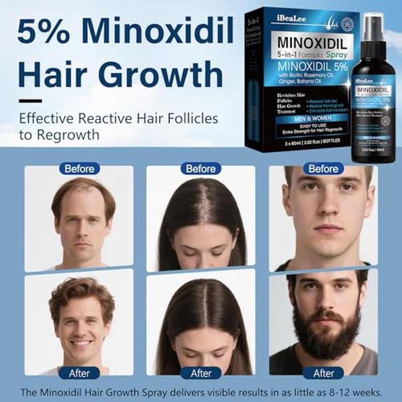 5% Minoxidil Hair Growth Spray for Men & Women | Biotin & Rosemary