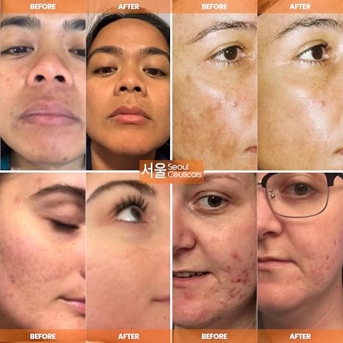 SeoulCeuticals 20% Vitamin C Serum with CE Ferulic & Hyaluronic Acid