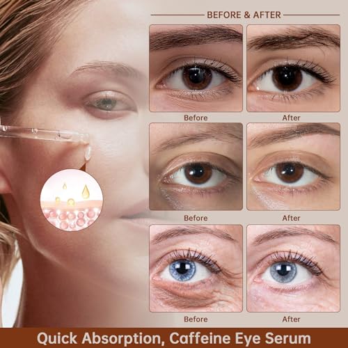 Caffeine Solution 5% + EGCG For Dark Circles & Puffiness, 30ML Anti Aging Caffeine Under Eye Serum For Eye Bags, Fine Lines, Moisturizing Caffeine Solution.