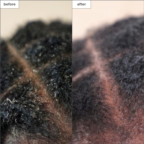 Briogeo Scalp Revival Charcoal + Tea Tree Scalp Treatment | Leave-In Serum for Dry, Flaky, or Itchy Scalp | Hydrating & Balancing | Vegan & Cruelty Free | 1 oz