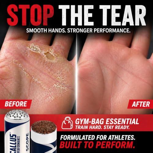 Hand Care System Bundle for Weightlifting & Gymnastics | Prevent Rips