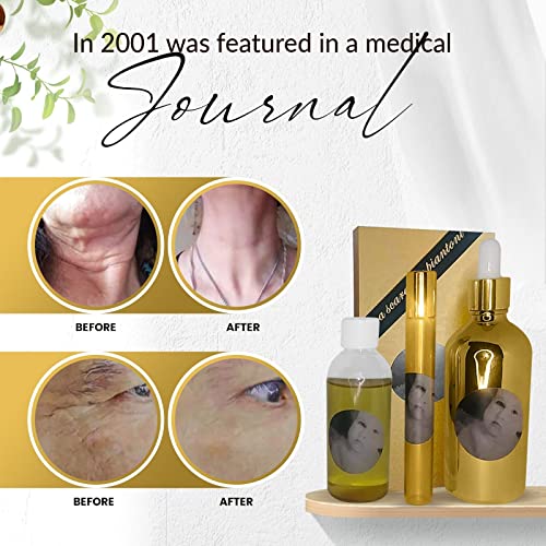 MEGAMOISTURIZER TURKEY NECK ROLL ON Facial Serum Kit - Anti Aging Serum for Neck and Face Massage Reduces Fine Lines Tightens Skin Anti Wrinkle Serum - Face Serum Roller with Refill (15 + 80 ml)
