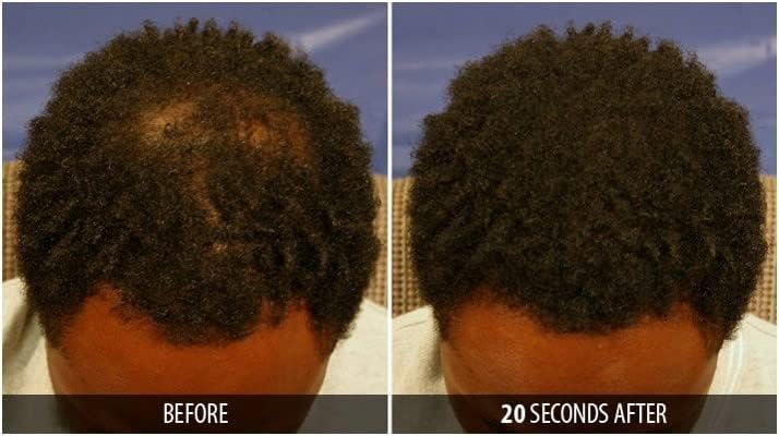Dr. Yates MD Keratin Fiber Hair Enhancer Dark Blonde