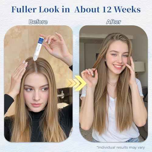 Hair Growth Serum Roll On 25ml with Saw Palmetto, Rosemary & Pea Extract£¬Helps Support Thicker, Fuller Hair Appearance£¬Clean, Non-Greasy Hair Loss Support for Men & Women Pack of 1