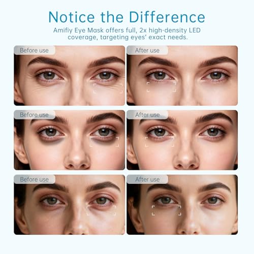 Red Light Therapy for Eyes, 3 Minutes Infrared Red Light Eye Mask for Under Eye Dark Circles, Eye Bags & Wrinkles, Collagen Booster Anti-Aging Device For Women & Men, Soft Silicone