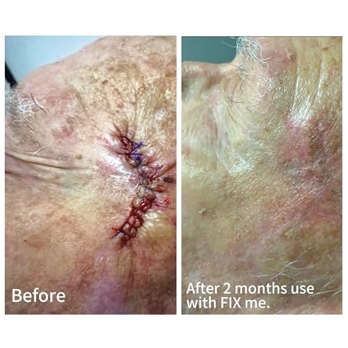 The Skin Experts- FIX ME - Advanced Scar Cream- Dermatologist developed by Dr. Alexander Dane