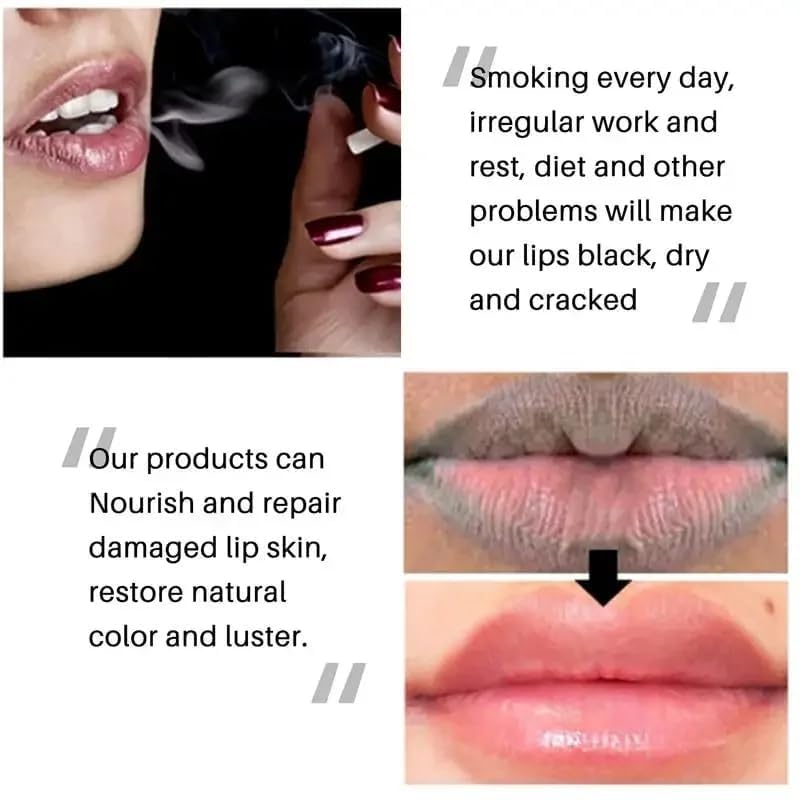Dark Lip Lightening Balm – Moisturizing & Hydrating for Men Women